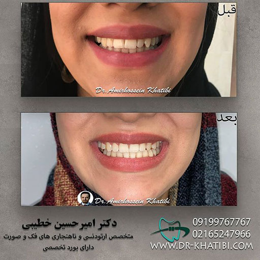 نمونه کار دکتر امیر حسین خطیبی