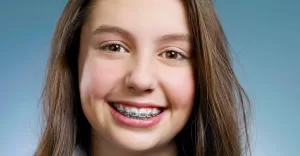 بهترین سن برای ارتودنسی چه سنی است
