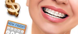 پرداخت هزینه ارتودنسی با بیمه تامین اجتماعی  