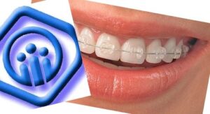 پرداخت هزینه ارتودنسی با بیمه تامین اجتماعی  