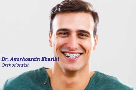 سن مناسب ارتودنسی