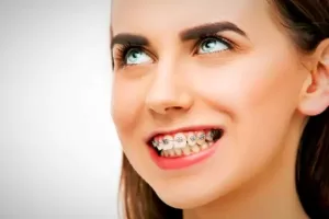 سن مناسب ارتودنسی