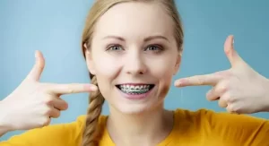 قیمت ارتودنسی یک دندان یا یک فک بالا