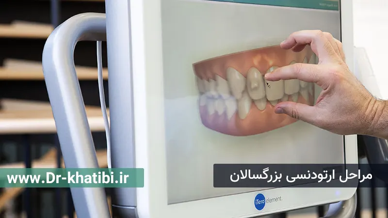 مراحل ارتودنسی بزرگسالان