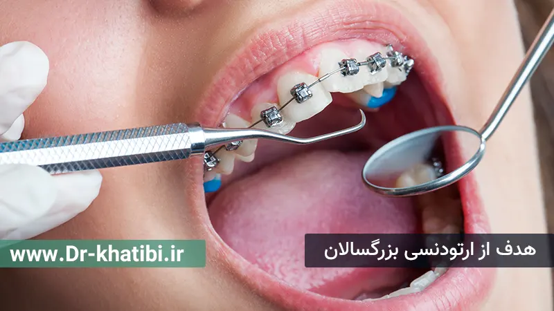 هدف از ارتودنسی بزرگسالان
