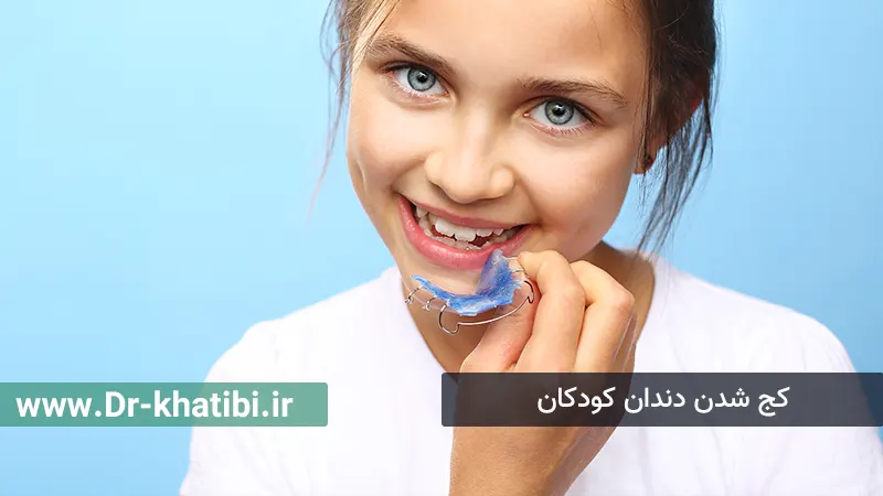 کج شدن دندان کودکان