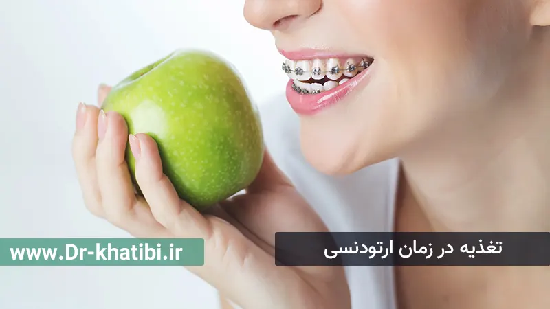 تغذیه در زمان ارتودنسی