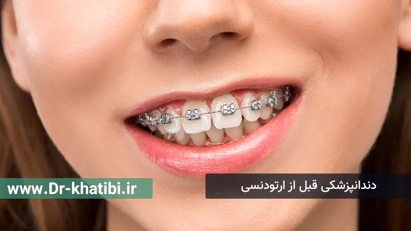 دندانپزشکی قبل از ارتودنسی