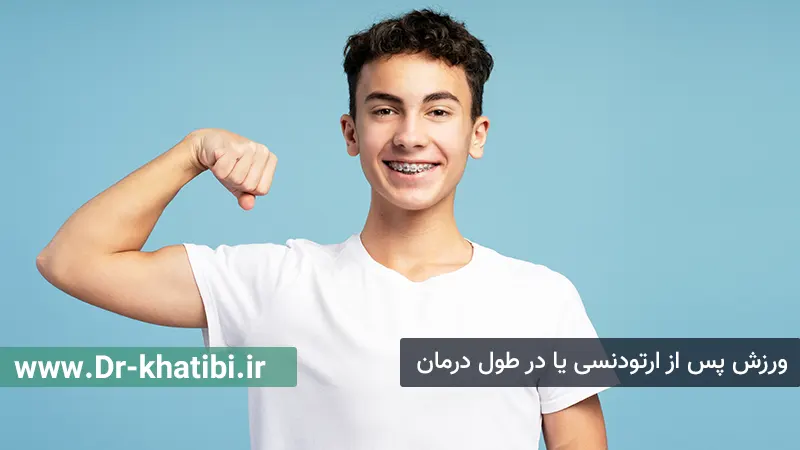 ورزش کردن پس از ارتودنسی