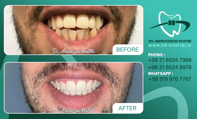 amirhossein_khatibi_305712881_207569948282127_2476620804253062480_n