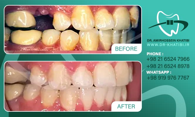 amirhossein_khatibi_305712883_20751699482825127_2476620804253062480_n