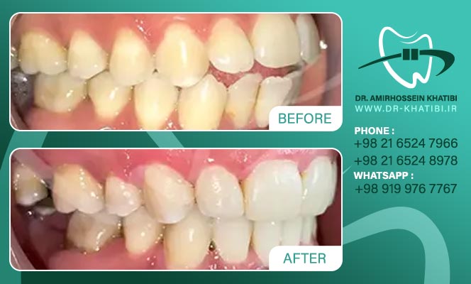 amirhossein_khatibi_305712883_207569948282127_2476620804253062480_n