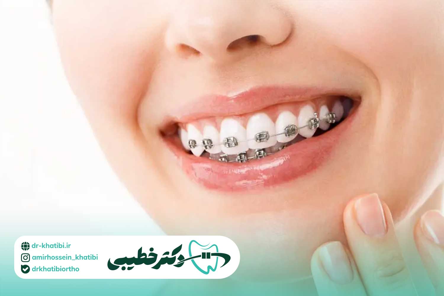 ارتودنسی ارزان یا اصولی؟ چرا انتخاب متخصص مهم‌تر از قیمت است