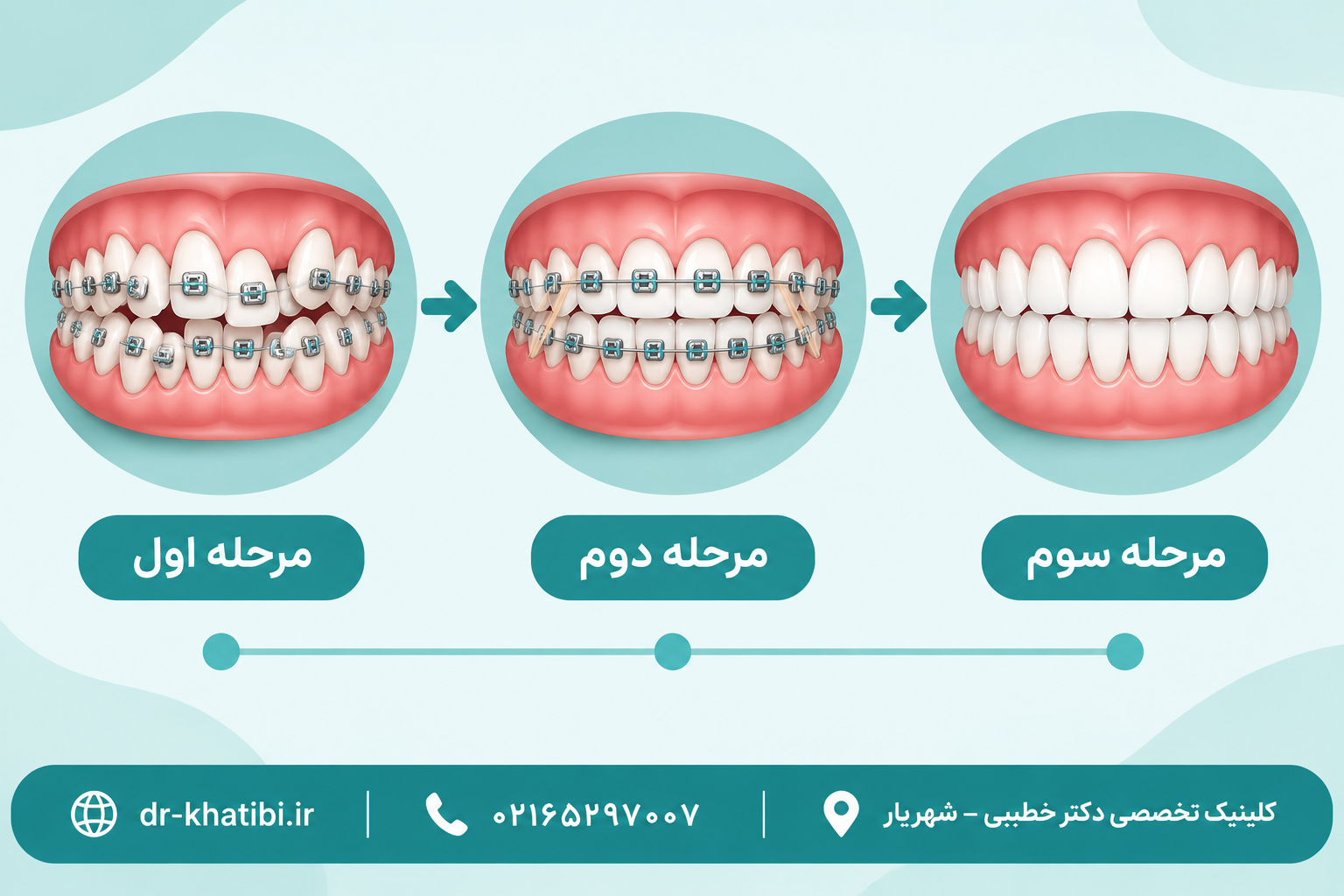سرعت تغییر هر فک در ارتودنسی | چرا فک بالا و پایین همزمان مرتب نمیشوند؟ | دکتر امیرحسین خطیبی، متخصص ارتودنسی شهریار