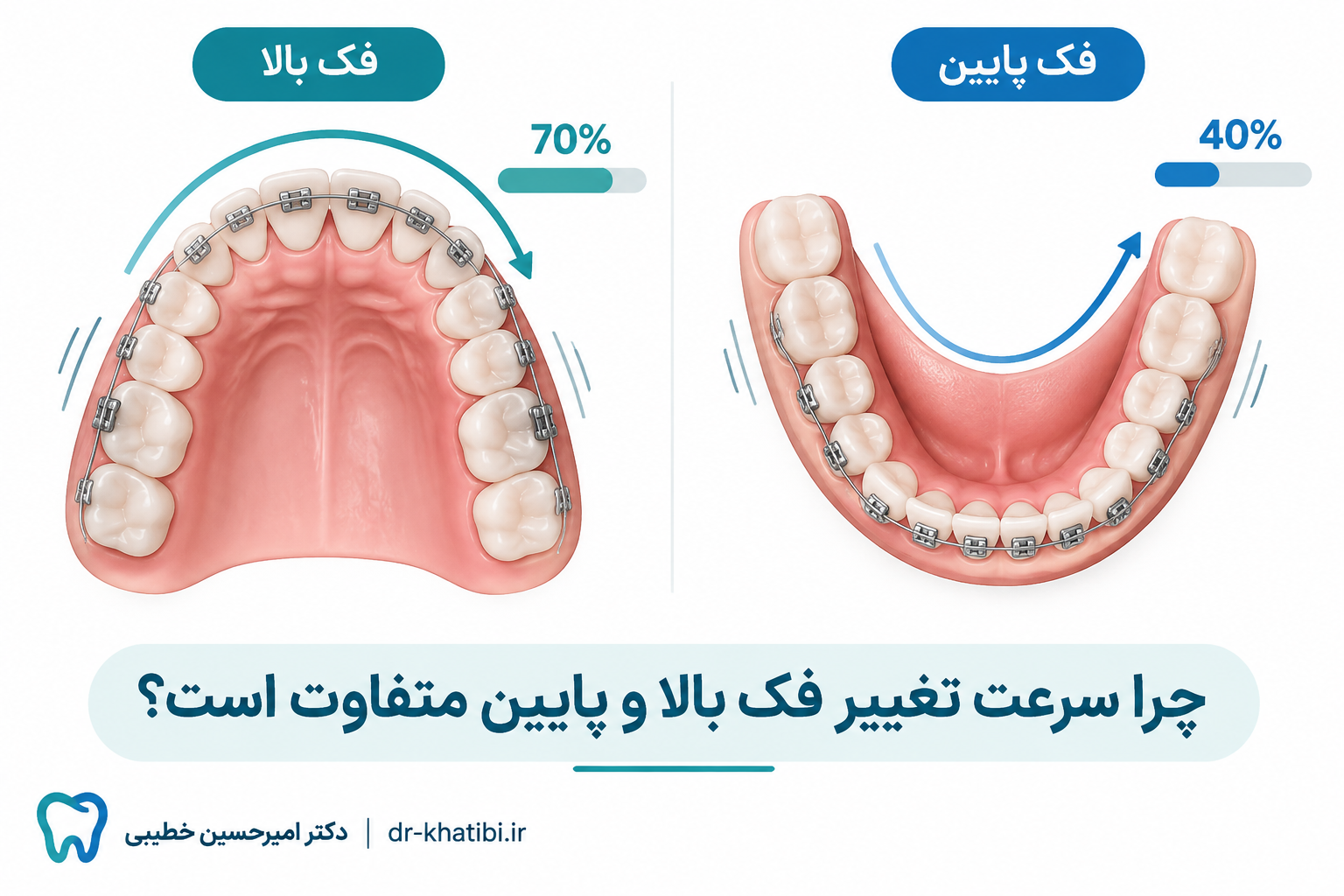 سرعت تغییر هر فک در ارتودنسی | چرا فک بالا و پایین همزمان مرتب نمیشوند؟ | دکتر امیرحسین خطیبی، متخصص ارتودنسی شهریار