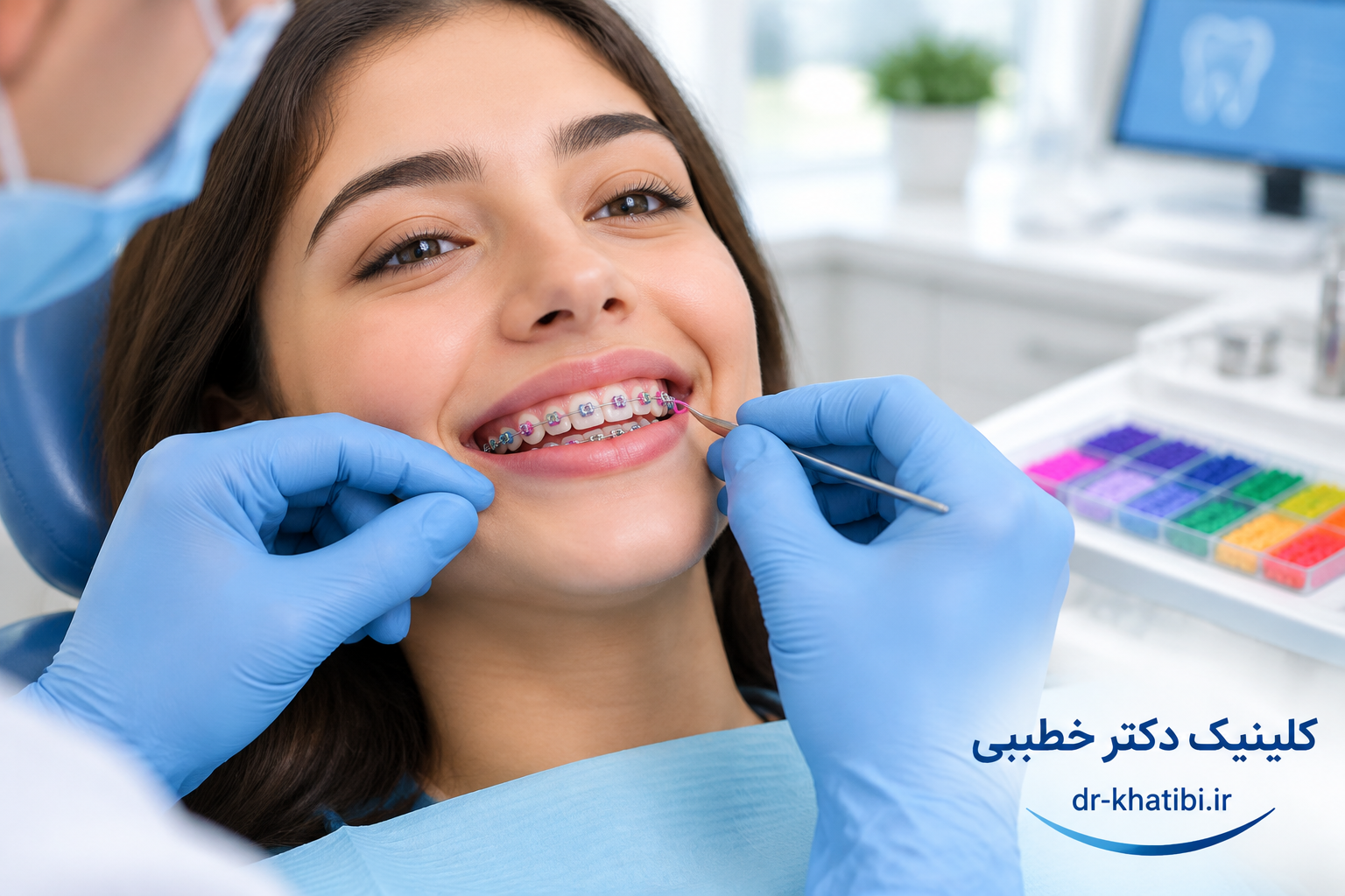 کش ارتودنسی چیست و چه کاربردی دارد؟ + راهنمای کامل استفاده